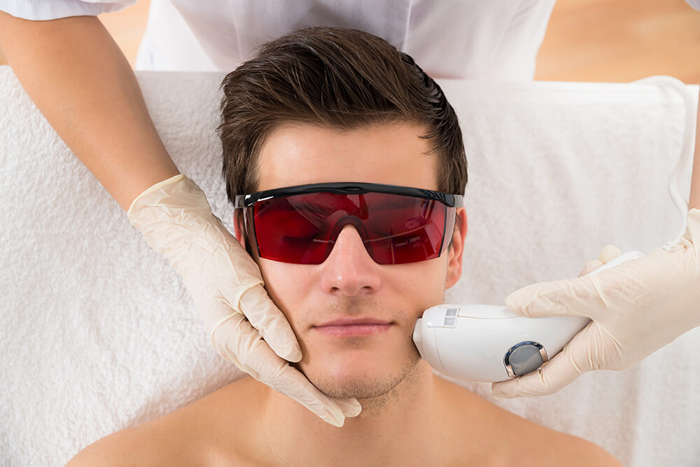 men laser hair removal